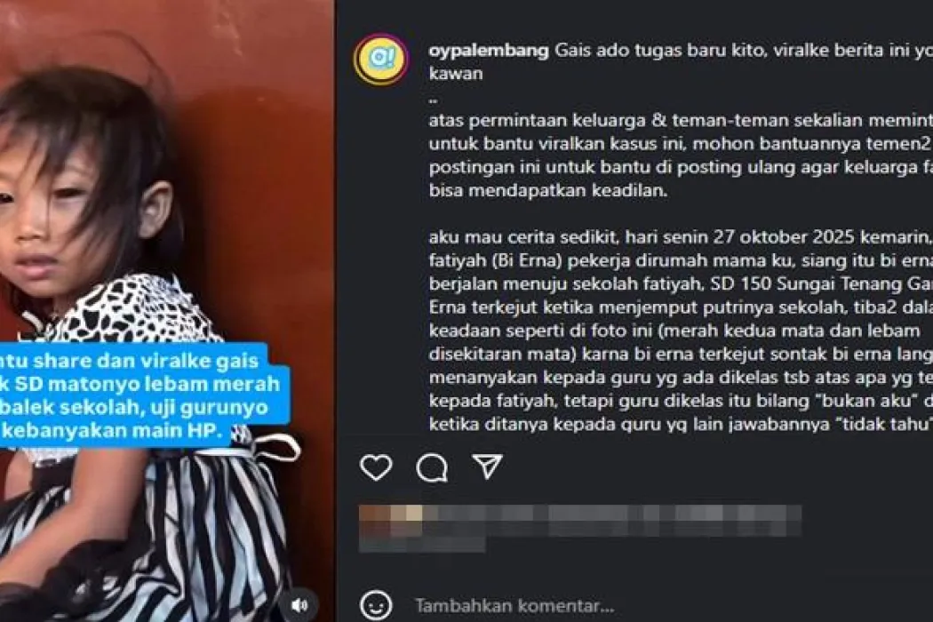 Viral Mata Siswi SDN 150 Gandus Palembang Merah Usai Pulang Sekolah, Guru Klaim Akibat Main HP
