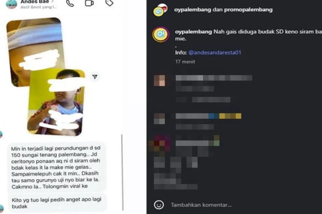 Siswa SD Negeri 150 Jadi Korban Bully Teman Sekelas, Tubuh Melepuh Disiram Kuah Mie